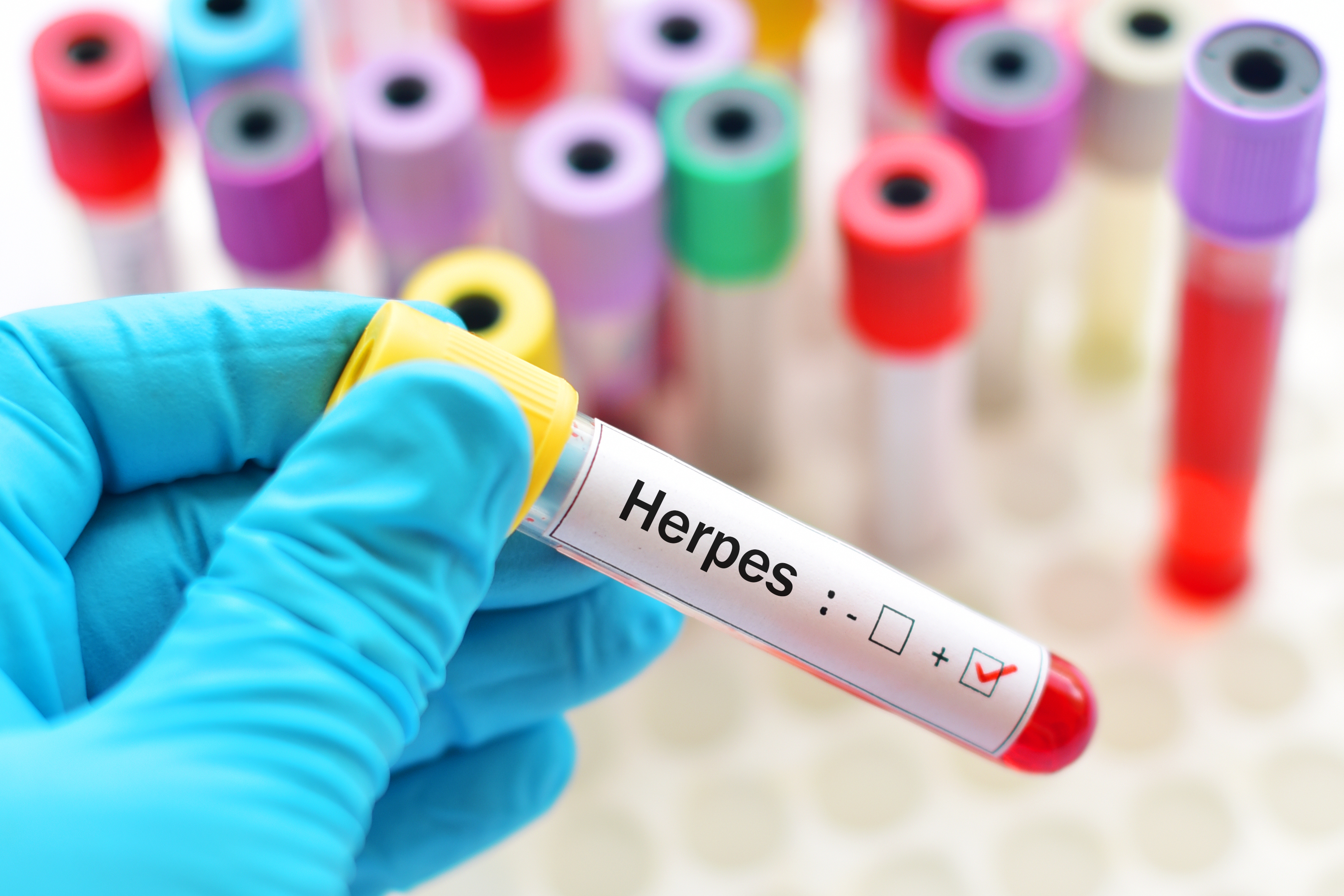 how long should i take acyclovir for genital herpes