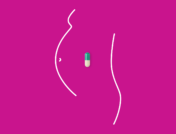A pill inside the outline of a woman's stomach represent antidepressants and pregnancy.