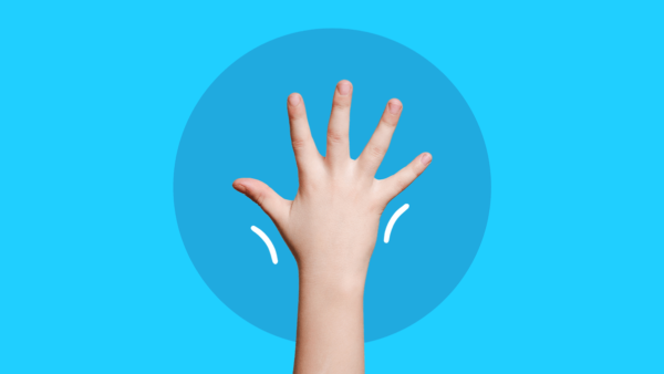 A hand represents juvenile arthritis