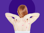 Xulane, birth control patch