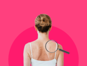 What a dermatologist can do