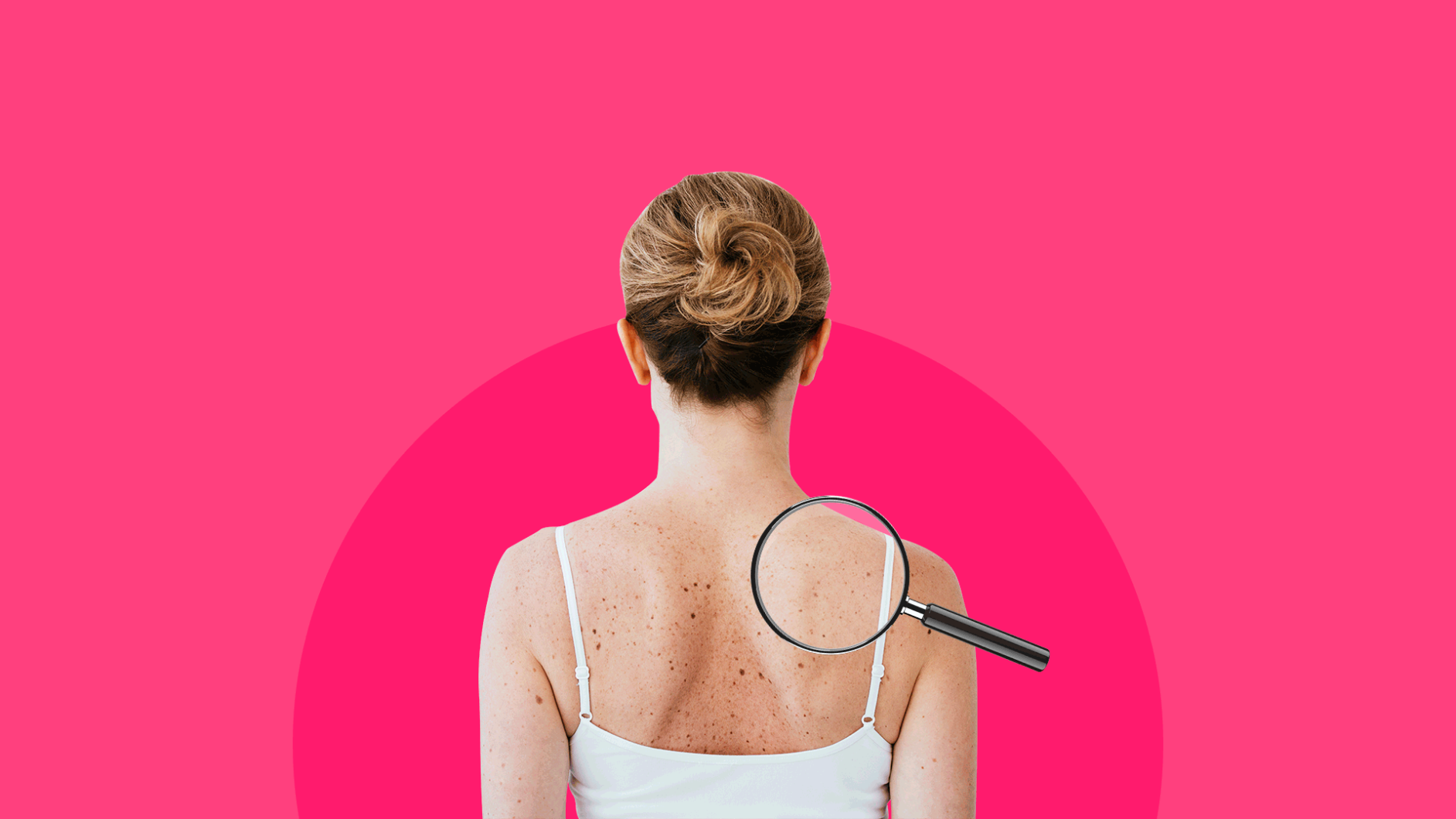 What a dermatologist can do