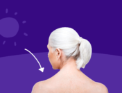 Photosensitivity: What is a sun allergy? Causes, symptoms, treatments