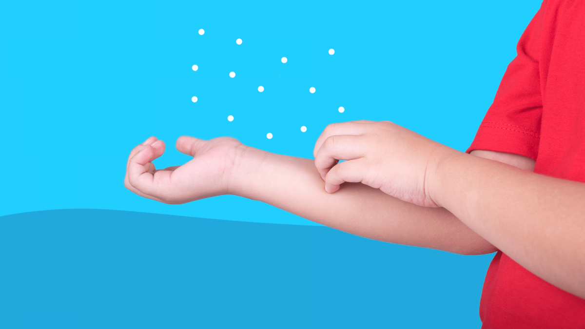 Ringworm in kids The parent’s guide to symptoms and treatment