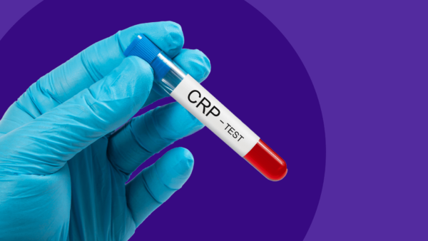 What are normal CRP levels?