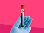 An image of a vial of blood represents bloodletting