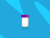 urine sample jar - urinalysis