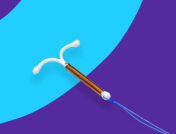 Rx IUD: What can I take instead of Mirena?