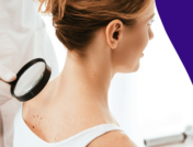 Dermatologist using a microscope to conduct a skin check