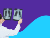 Medical professional reviewing chest x-ray: Symptoms of pulmonary embolism