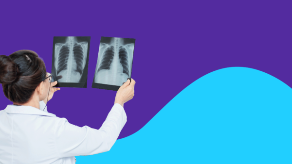 Medical professional reviewing chest x-ray: Symptoms of pulmonary embolism