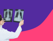 Medical professional looking at chestx-rays: What causes pain under the left rib cage