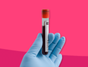 Latex gloved hand holding blood test vial: What is globulin?