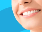 A close up of a woman smiling: Dental implant cost