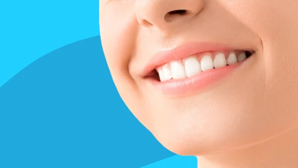 A close up of a woman smiling: Dental implant cost
