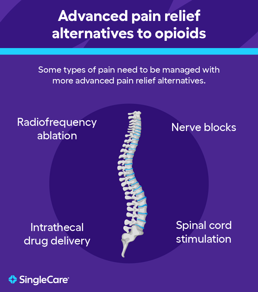 An illustration of a spine: Advanced pain relief options include nerve blocks or spinal cord stimulation